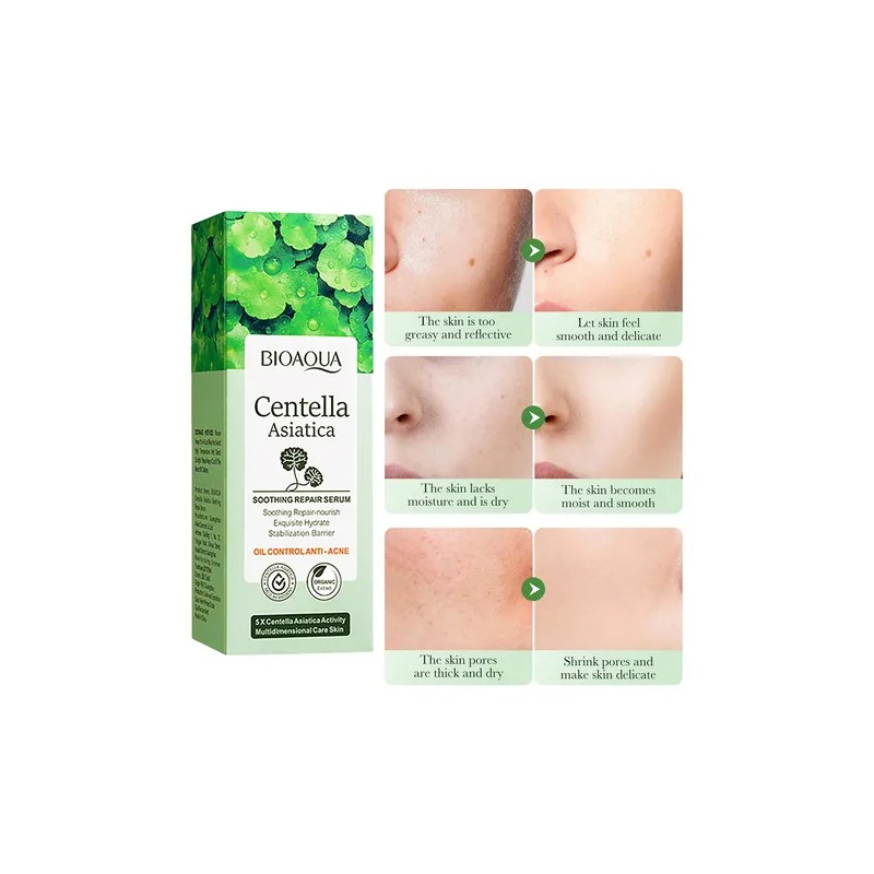 Serum Bioaqua Centella Asiatica Antiacn Control Grasa Todo Tipo De