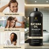 INFINA ESSENTIALS Batana Oil Shampoo with Biotin & Tea Tree