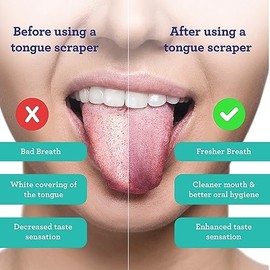 GuruNanda Rascador de lengua (paquete de 2), rascador de lengua de acero inoxidable para higiene bucal, tratamiento de mal aliento, limpiador de lengu