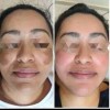 Crema Facial Lumi Radiance+tónico Lumi Radiance/ Farmasi