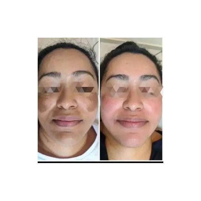 Crema Facial Lumi Radiance+tónico Lumi Radiance/ Farmasi