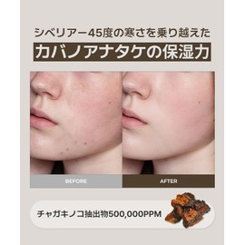 SERUMKIND,Chaga Mushroom Serum 30ml | High Moisturizing, Nutrient-Rich, Fine Line & Shrinking Skin Care, Hydration & Firmness.1.01 oz