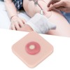 Abscess Incision Drainage Pad Sebaceous Cyst Surgical Removal Training Skin