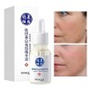 Serum Facial Bioaqua Aclara Manchas Acné Acido Hialuronico