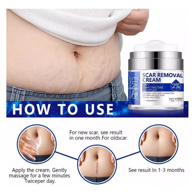 Crema/gel para cicatrices profundas, queloides, cacarizos