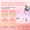 Blackhead Remover Pore Vacuum Upgraded Facial Pore Cleaner Electric Comedone