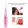 Petyoung Tonsil Stone Remover Tool, LED Earwax Removal Stainless Steel