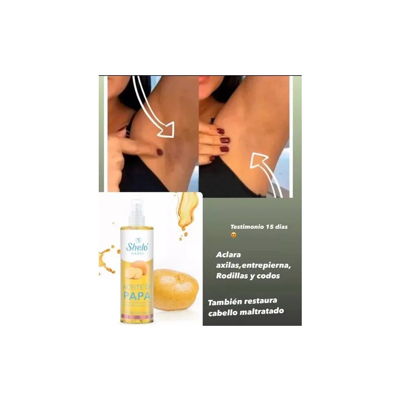 Kit Aclarador De Axilas Aceite De Papa, Desodorante Sheló Na
