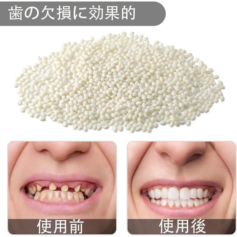 ShuaWdk Dentures, Dental Resin, Fitting Beads Teeth, Teeth Repair Kit