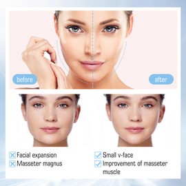 Xiulilydai V-Shaped Face Mask, Ear Hook 4D V-Shaped, 5 Pieces, Chin Firming, Reshape Young Face, Gel Face Mask for V Shape