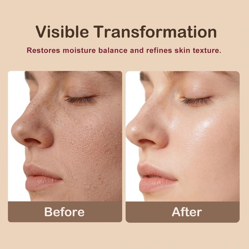 Glow Rice Toner - Sylona Hydrating Facial Toner for Brightening