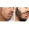 Crecer La Barba Bigote Cejas Profesional Y Natural Novocrin