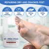 Urea Cream 40% for Feet, Hands, Heels & Elbows -