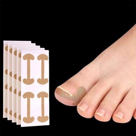 Toe Tape Band Toenail Nail Sticker Resistance Care Protection Supplies Patch Toenail Nail Care Tool 4pcs One set 5ea
