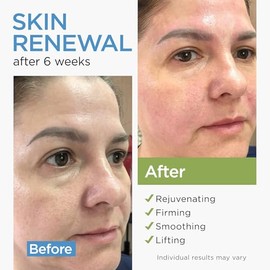 Crema facial hidratante de colágeno antienvejecimiento con células madre, retinol, ácido hialurónico y niacinamida, crema hidratante de día y noche pa