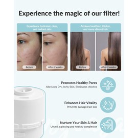 SANYCASA Shower Filter for Beauty Shower Head, KDF-55 Filter Dermatologist Recommended for Softening Hard Water, Improves Hair, Nails & Skin