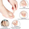BBTO 2 Pcs Budin Toe Splint Hammer Toe Straightener Support