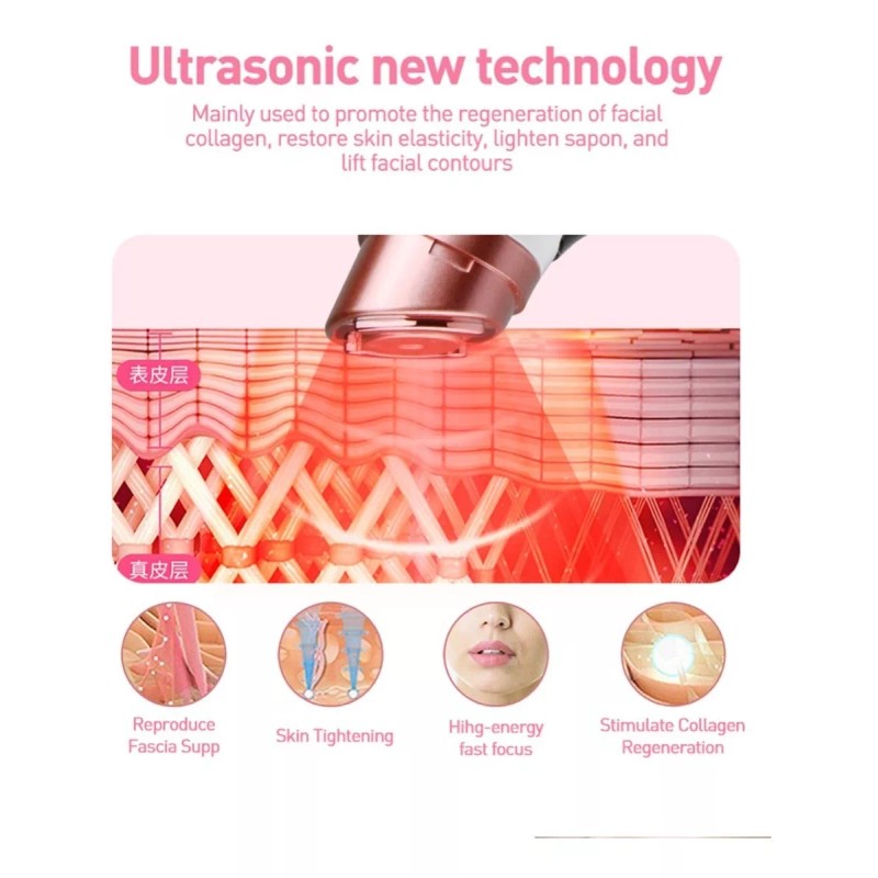 Mini Hifu Hifu Mini 2th Generation Lifting Facial Radiofrecuencia Sms