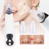Electric Blackhead Removal Machine Adjustable Vacuum Suction Oil Control Pore