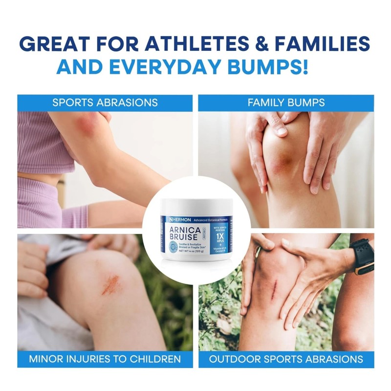 Hermon Arnica Bruise Cream Extra Strength: Fast-Acting for Bruising &