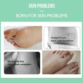 5 Pairs Sea Salt & Aloe Foot Peel Mask for Hard Skin – Moisturising Foot Socks for Dry Feet – Cracked Heel Repair Treatment – Soothes, Softens & Refreshes Feet – Cleanses Foot Mask Socks