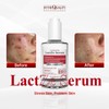 By the Quality Lactje Ampoule Serum 50ml Trouble Millet Sebum