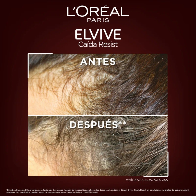 L'oréal Paris Serum Capilar Antiquiebre Con Aminexil 102ml