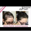 Ivonne&ivett Ampolleta Capilar