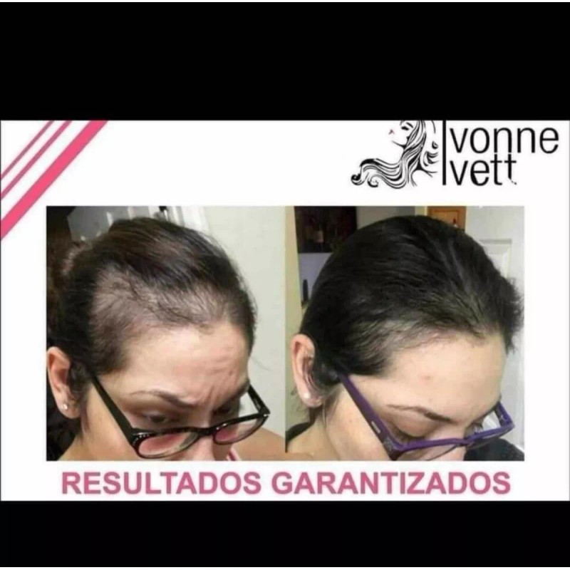Ivonne&ivett Ampolleta Capilar