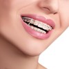 Xumann 400 PCS Orthodontic Elastic Bands, Braces Band for Dentist