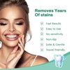 Teeth WHITENING Strips-Dentists FORMULATED-Residue Free-Non Sensitive-Enamel Safe-Mint FLAVOUR-14 Treatments 28