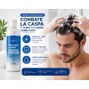 Shampoo Alquitran De La Hulla, Psoriasis Caspa, 3 500ml
