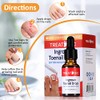 Treatonic Tratamiento de uñas encarnadas – Kit de alivio del