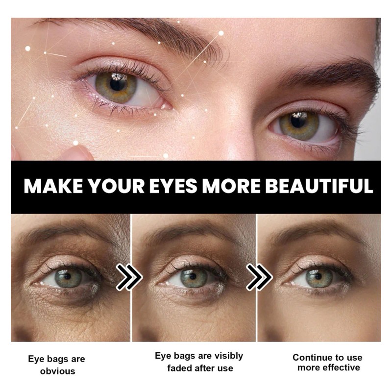 Crema De Péptidos Firmes Para El Endurecimiento De Ojos X,