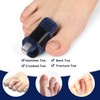 Ajoysoul Toe Splint for Women & Men, Adjustable Straightener Relief