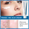 Dark Spot Cream, Tran/xamic Acid & Niacin/amide Face Cream for