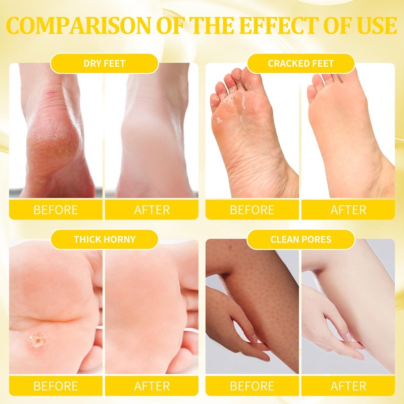 pedicura para pies secos, kit de spa para pies en
