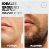 RECOVRY Beard Roller Beard Growth - Derma Roller for Maximum