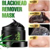 Kit de Mascarilla Eliminadora de Puntos Negros de Carbón Despegable