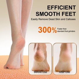 CYBNOTA Electric Foot Callus Remover, Powerful Dual Speed Electric Foot File Callus Remover for Feet, Foot Scrubber for Dry, Cracked, Callused Skin