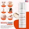 Mesoderm RX Anti Sun Spots, 50ml