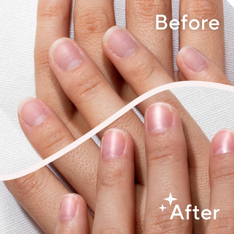 Finishing Touch Flawless Salon Nails Kit, Electronic Nail File and