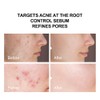 pure.tiful 2% Salicylic Acid (BHA) Serum for Acne & Blackheads