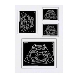 4 x 'Ultrasound Baby Photo' Temporary Tattoos - Water Resistant, Skin-Safe, Non-Toxic Transfers, Mixed Sizes (TO00084138)