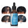 Hair Growth Serum