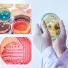 MELGO 5 Pcs Plastic Petri Dish, Sterile Bacterial Culture Dish,
