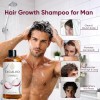 Shampoo De Cebolla Generic Para Crecimiento Capilar