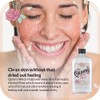 Quinn’s Alcohol Free Witch Hazel with Aloe Vera 16 Ounce