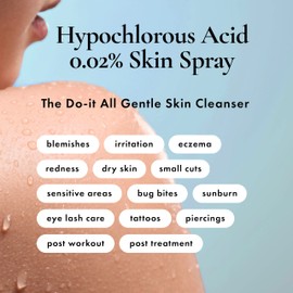 Hypochlorous Acid Spray for Face, Skin & Eyelids – pH-Balanced HOCl Facial Spray Safe for Acne, Red & Sensitive Skin – Gentle Non-Toxic Toner & Cleanser Mist for Clear, Hydrated Skin, 8 oz