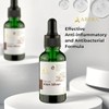 ABERA Alan Silver Dandruff Treatment, Hair Loss Prevention Serum -